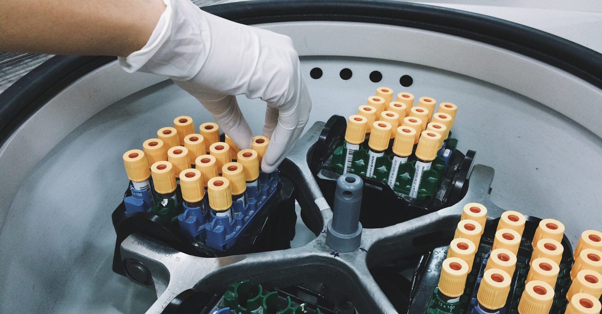 Balancing tubes for ultracentrifugation a tedious task? aliQ 2 can